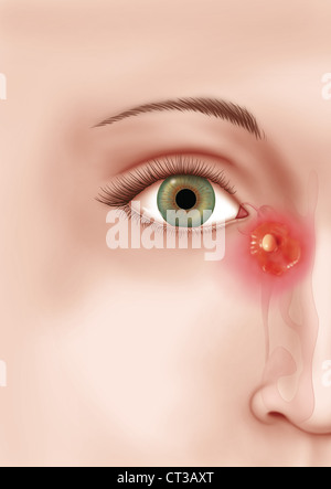 LACRIMAL APPARATUS, DRAWING Stock Photo - Alamy