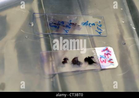 Two slides of various bacterial specimen, ready for analysis. Stock Photo