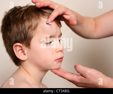 CHILD WITH HEMATOMA Stock Photo