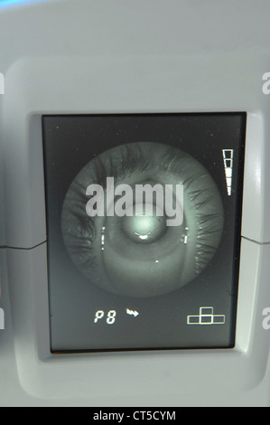 FUNDUS OCULI EXAMINATION Stock Photo