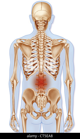 LOWER BACK PAIN, ILLUSTRATION Stock Photo