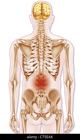 LOWER BACK PAIN, ILLUSTRATION Stock Photo