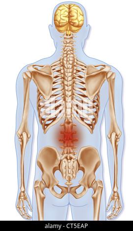 LOWER BACK PAIN, ILLUSTRATION Stock Photo