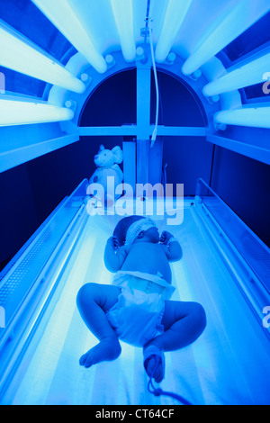 NEONATAL JAUNDICE, PHOTOTHERAPY Stock Photo