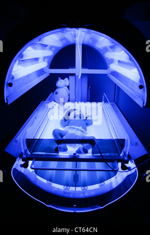 NEONATAL JAUNDICE, PHOTOTHERAPY Stock Photo