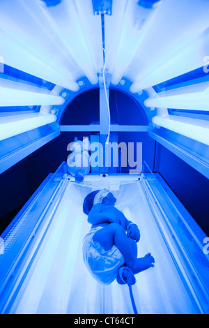 NEONATAL JAUNDICE, PHOTOTHERAPY Stock Photo