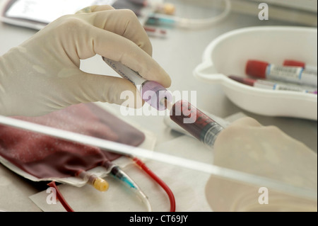 CORD BLOOD ANALYSIS Stock Photo