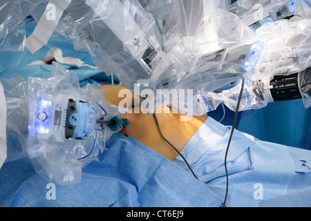 ROBOT-ASSISTED SURGERY Stock Photo