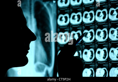 London, doctor assesses Roentgen and CT scans Stock Photo