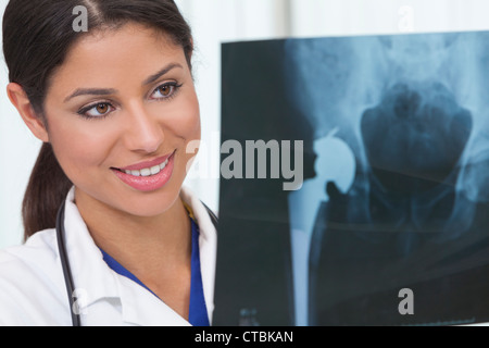 Female woman medical doctor holding artificial hip replacement x-ray in hospital Stock Photo