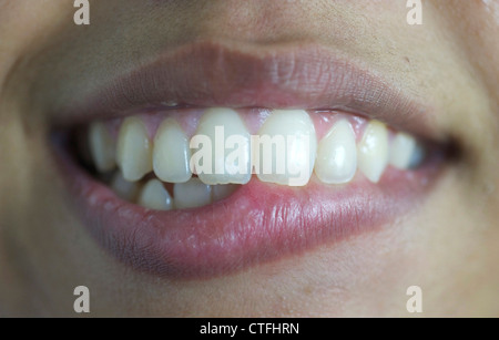 Teenage kids mouth close up teeth lips biting ones lip Indian dark skin Stock Photo