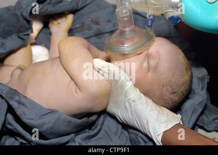 Infant delivered by Caesarean section. Stock Photo