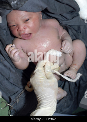 Infant delivered by Caesarean section. Stock Photo