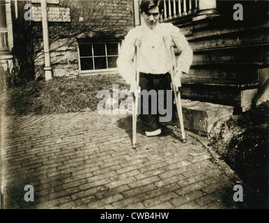 Child Labor, Frank, whose legs were cut off by a motor car in a coal mine in West Virginia when he was 14 years, 10 months of Stock Photo