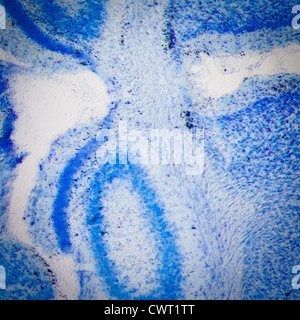 science medical microscopy micrograph, rat brain hippocampal neurons Stock Photo