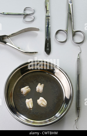 Instruments for primitive dental surgery and four extracted wisdom teeth Stock Photo