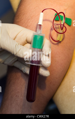 TUBERCULOSIS TEST BLOOD WORK visual data 7