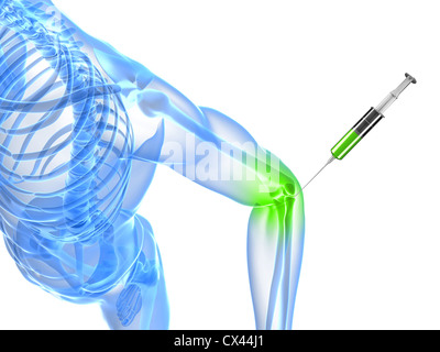 3d rendered illustration showing an elbow joint injection Stock Photo