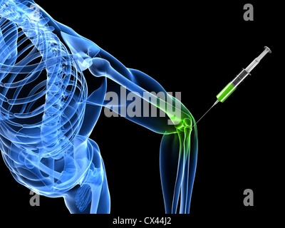 3d rendered illustration showing an elbow joint injection Stock Photo