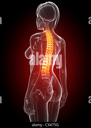 Painful back, illustration Stock Photo - Alamy
