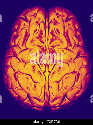 computer generated model human brain Stock Photo
