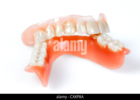 Partial dentures, Zahn-Teilprothese Stock Photo