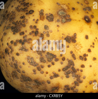 Powdery scab, Spongospora subterranea, lesions on a potato tuber Stock Photo