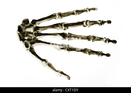 Bones of the human hand, anatomical illustration Stock Photo