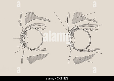 Cross-sectional view of the human eye, anatomical illustration Stock Photo