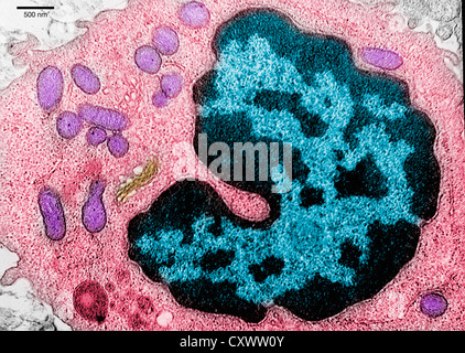 Transmission electron micrograph of lung tissue Stock Photo