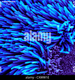 Scanning electron micrograph of lung trachea Stock Photo