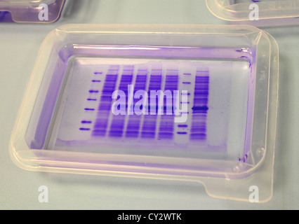Coomassie blue stained protein gels Stock Photo