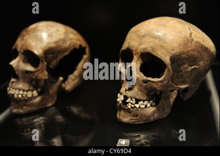 Skull of a young girl. 18-20 years old. 3500-3400 BC. Sigersdal Mose, Northern Zealand. National Museum of Denmark. Stock Photo