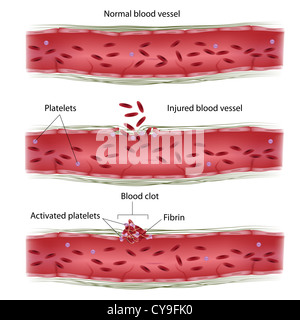 Blood clotting process Stock Photo