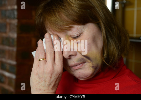 Battered and bruised woman portraying domestic violence. fear relationship violence injuries injured treatment frightened scared wife Stock Photo