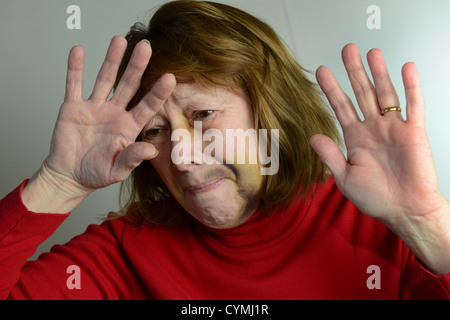 Battered and bruised woman portraying domestic violence. fear relationship violence injuries injured treatment frightened scared wife Stock Photo