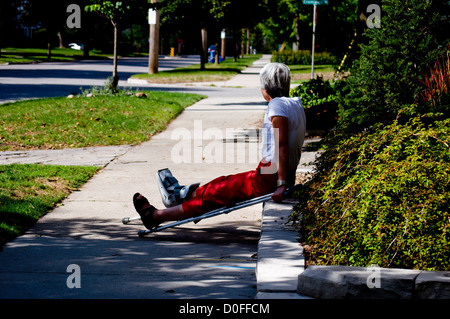 A woman with a cast on an injured foot rests during a walk Stock Photo
