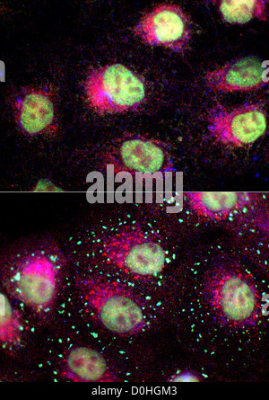 Normal and Stressed Prostate Cancer Cells, Microscopic View Stock Photo