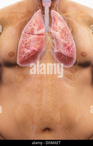 Human lungs layered over an overweight man's body to show the relationship between obesity and respiratory disorders. Stock Photo