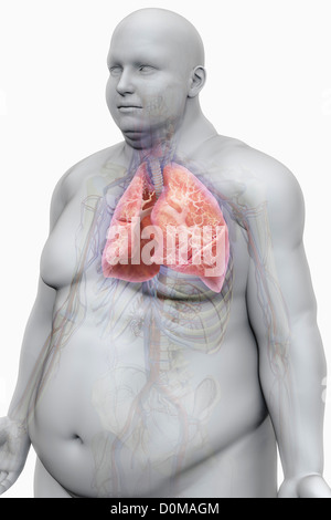 Human lungs layered over an overweight man's body to show the relationship between obesity and respiratory disorders. Stock Photo