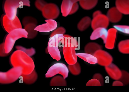 Sickle-cell disease sickle-cell anaemia or drepanocytosis is recessive genetic blood disorder characterized red blood cells Stock Photo