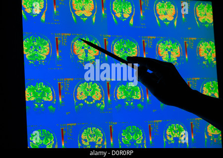 colored x-rays of cerebral cortex cerebellum human brain MRI Stock Photo