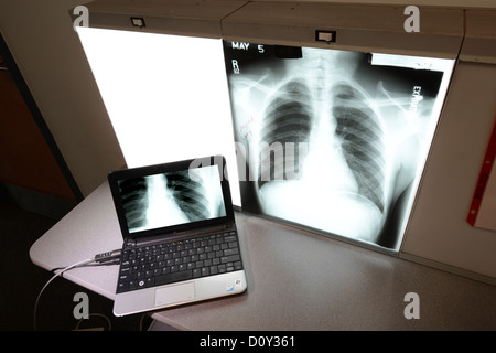 Chest X-ray & Computer, Doctors Office, USA Stock Photo