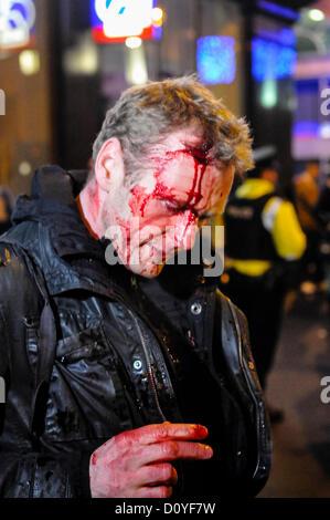 3rd December 2012, Belfast, Northern Ireland. A press photographer suffers injury to his head and hand, after being hit with a baton a number of times by a PSNI Officer while attempting to shoot the events at Belfast City Hall. Stock Photo