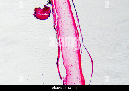 science micrograph of bone cell osteocyte Stock Photo - Alamy