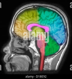 MRI of head showing brain structures Stock Photo