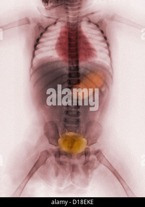 Anatomy of the Female Abdomen Stock Photo: 7713040 - Alamy