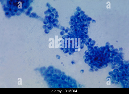 Photomicrograph of the fungus Candida albicans. Stock Photo