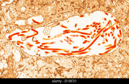 Transmission Electron micrograph of  Ebola virus Stock Photo