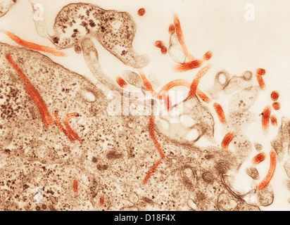 Transmission Electron micrograph of  Ebola virus Stock Photo
